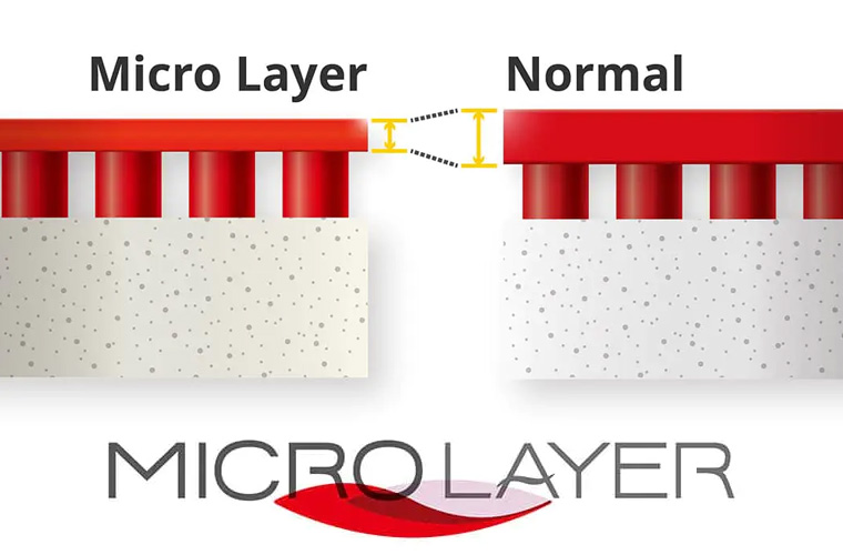 BUTTERFLY MICRO LAYER 1 BUTTERFLY MICRO LAYER 1